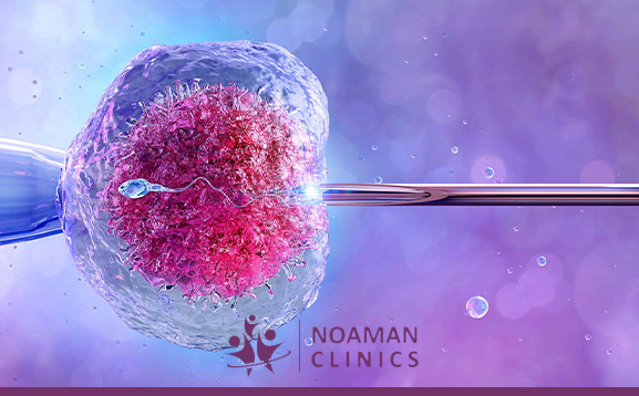 حقن التنشيط للحقن المجهري