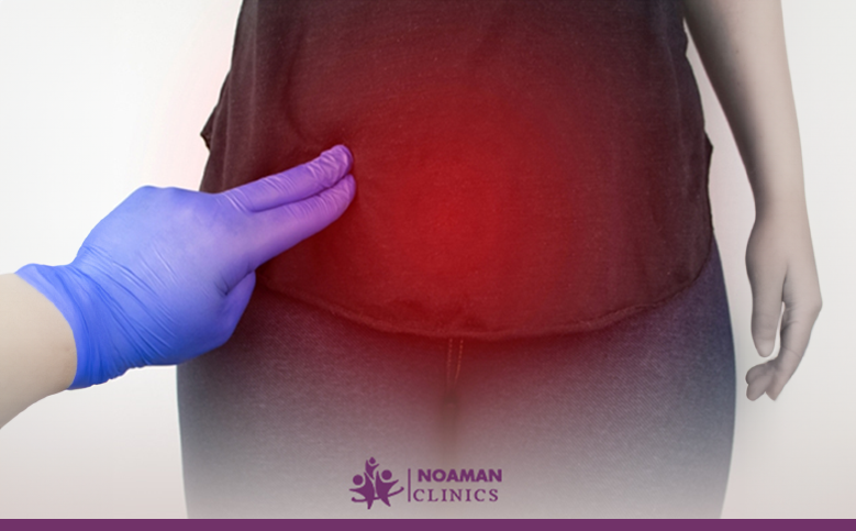 علاج المشيمة النازلة