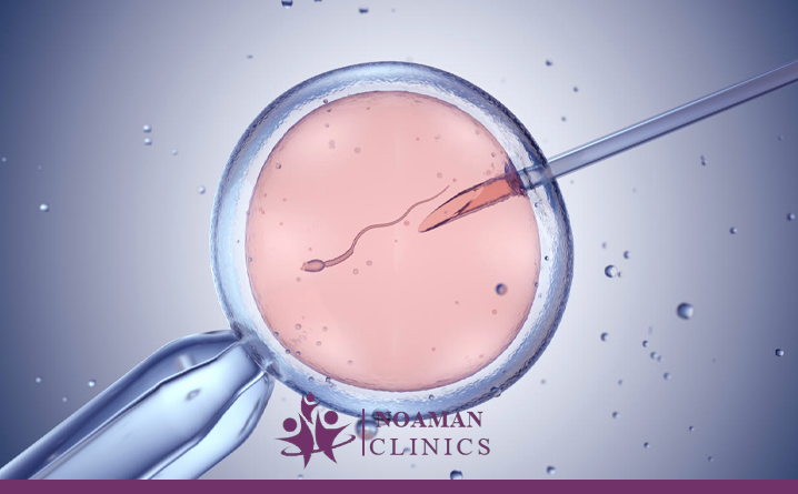 افضل مركز حقن مجهري في مصر