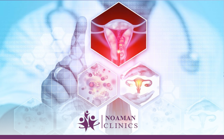 هل يتحول الورم الليفي في الرحم إلى سرطان