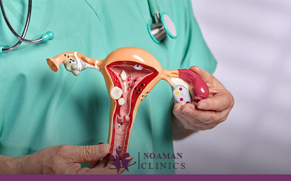 الفرق بين الورم الليفي والسرطان في الرحم